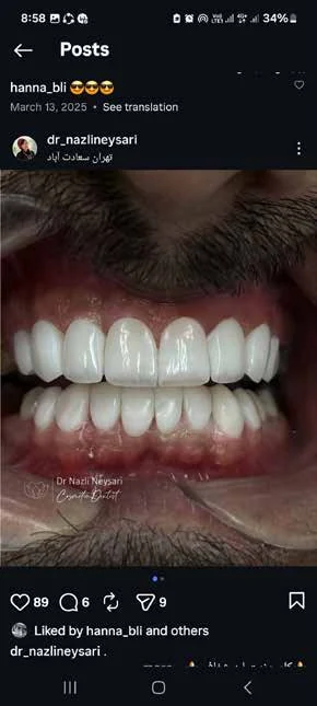کامپوزیت فک بالا و پایین