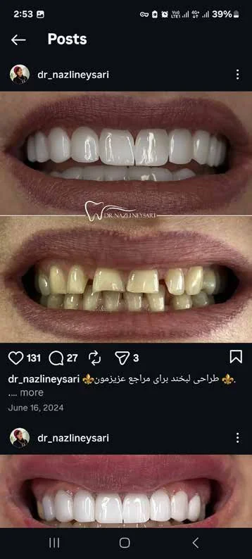 اصلاح فرم دندان‌ها
