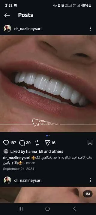 بازسازی لبخند