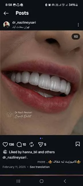 کامپوزیت کم‌تراش