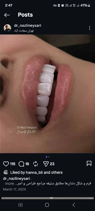 اصلاح قرینگی
