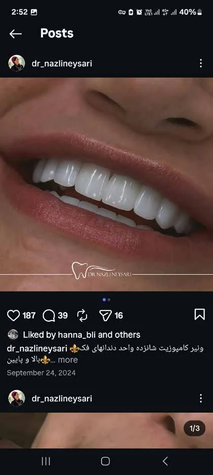 لبخند روشن و طبیعی